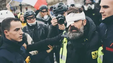 Jérôme Rodrigues éborgné : deux policiers mis en examen