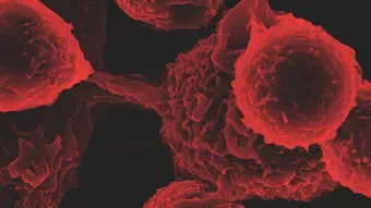 Viral 13 / Quand arrive la variole du singe, demeure l'énigme SARS-CoV-2