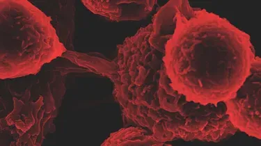 Viral 13 / Quand arrive la variole du singe, demeure l'énigme SARS-CoV-2