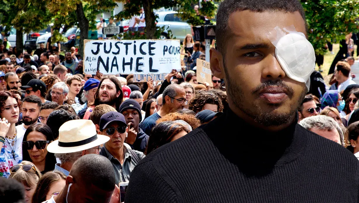 Violences policières : Virgil, 24 ans, éborgné par un tir de LBD