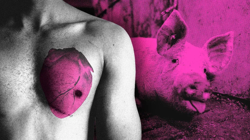 Les cochons sauveront l’humanité