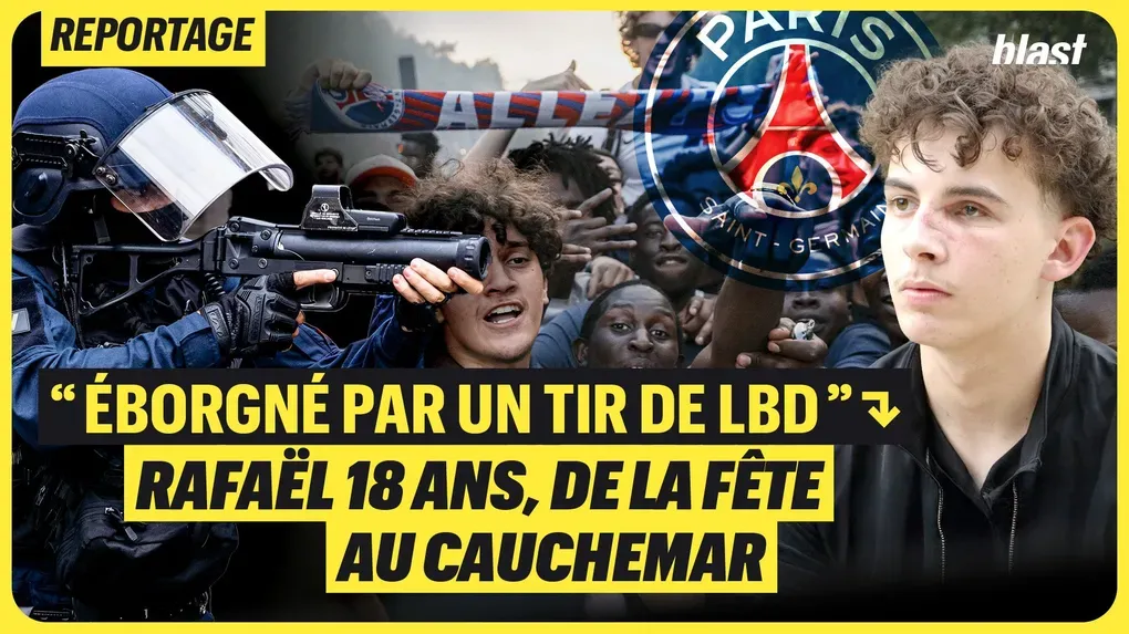 "Éborgné par un tir de LBD" : Rafaël 18 ans, de la fête au cauchemar